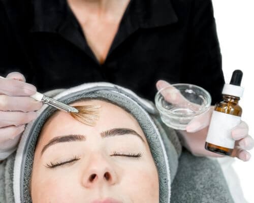Chemical peel