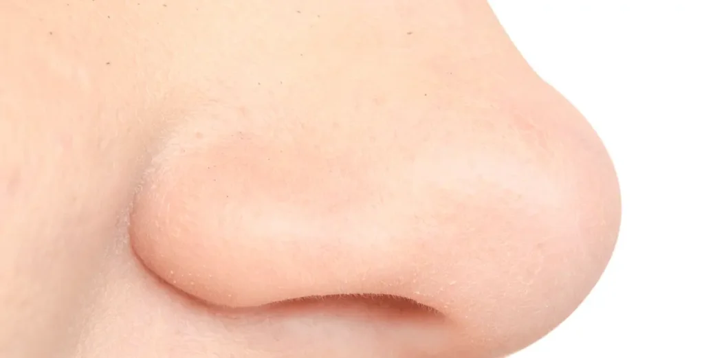 Nose