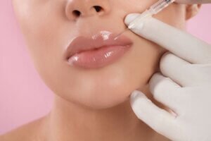 Woman having lip fillers