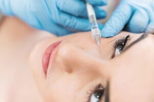 Woman having tear trough fillers under eye