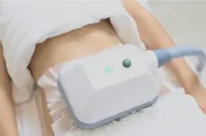 Fat freezing treatment on female stomach